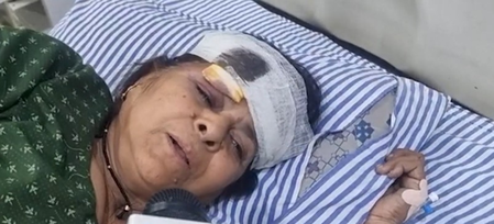 ‘Was travelling with my husband… don’t know where he is now’: Victim of Greater Noida bus fire